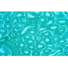 人卵巢畸胎瘤細胞；PA-1	